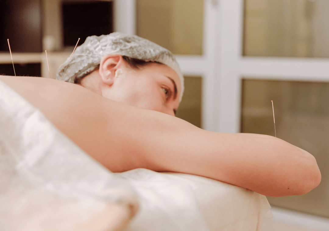 The Ins and Outs of Acupuncture: What is It Used For and How Does It Work?